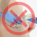 3D-Printed, Natural Breast Tissue Implants: A New Era in Reconstruction?