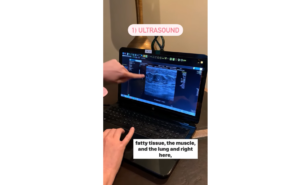 Let’s Take A Closer Look At 3 Types Of Breast Imaging Tests