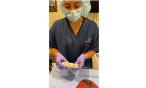 This Is How We Biopsy A Breast Tumor After Mastectomy