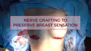 Watch How Our Surgeons Use Nerve Grafts to Preserve Sensation After Breast Cancer Surgery