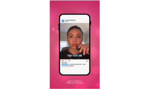 1 Year After Mataya’s Double Mastectomy & Reconstruction Surgery