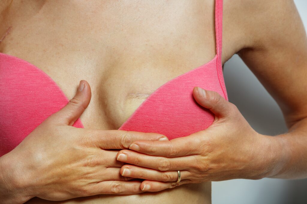 breast reconstruction guide