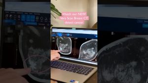 Watch the Vera Scan Breast CT Detect Breast Cancer